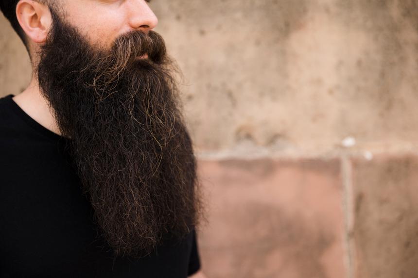 24-летний студент из Франции покончил с собой после неудачной операции по пересадке бороды