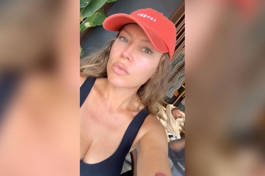 «Ходила бы с грыжами лучше»: Рита Дакота пожалела о блефаропластике