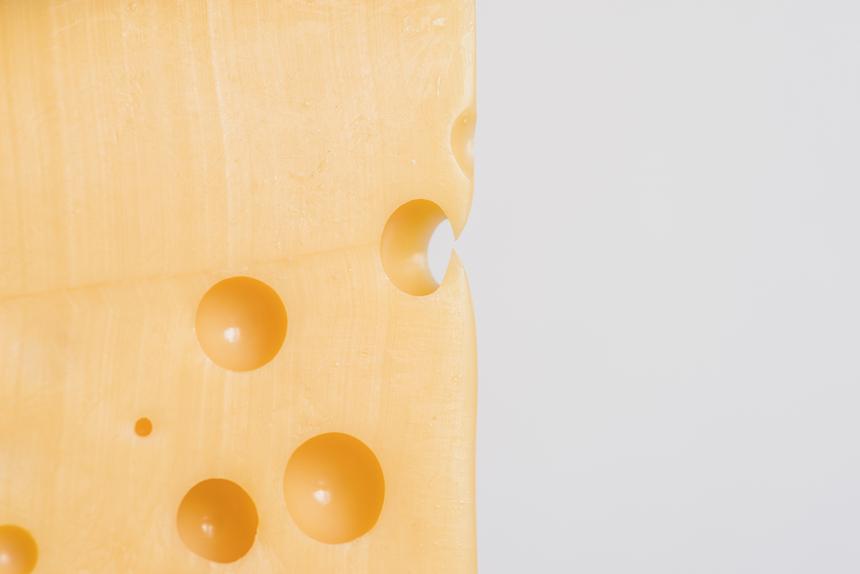 Ел только сыр, говядину и масло: из тела мужчины начал сочиться холестерин