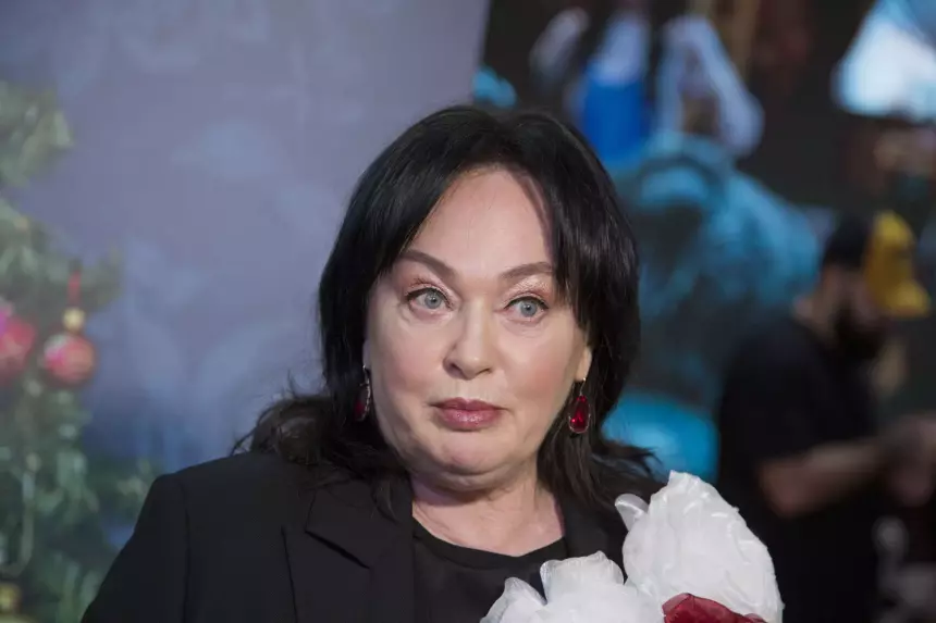 Хирург Байрамукова считает, что Гузеева делала подтяжку лица и блефаропластику