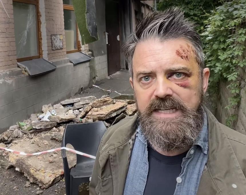 В Киеве балкон многоэтажного дома рухнул вместе с режиссером из США Уолтерсом