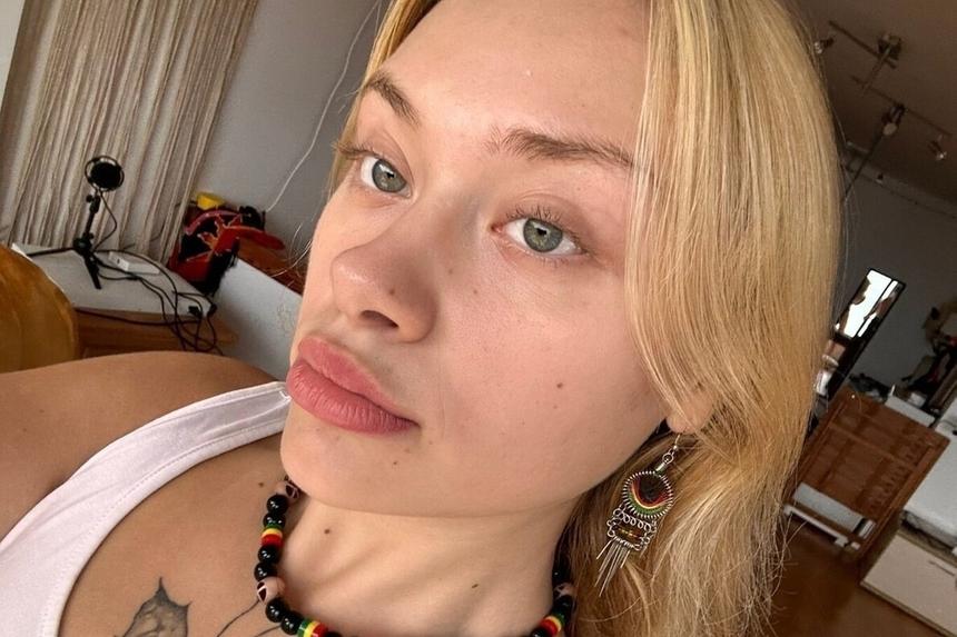 В инвалидном кресле: искалеченная в Дубае модель Ковальчук показала, как сейчас выглядит