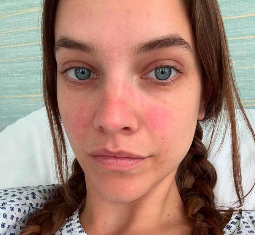 «Теперь я внимательнее отношусь к своему телу»: модель Барбара Палвин перенесла операцию