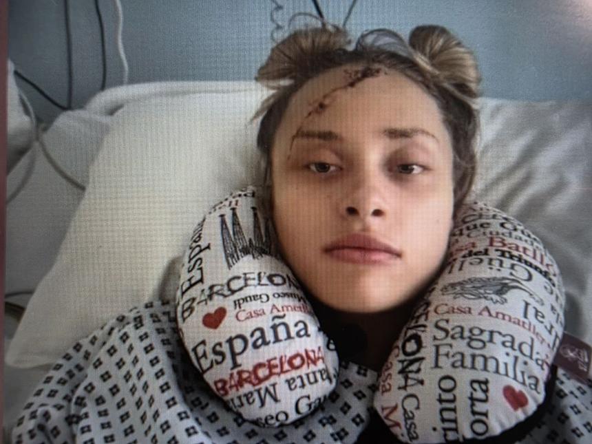 «После тяжелых ситуаций»: Мария Ковальчук показала фото из больницы с глубоким шрамом на лице